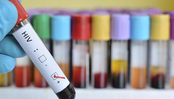 aids-2